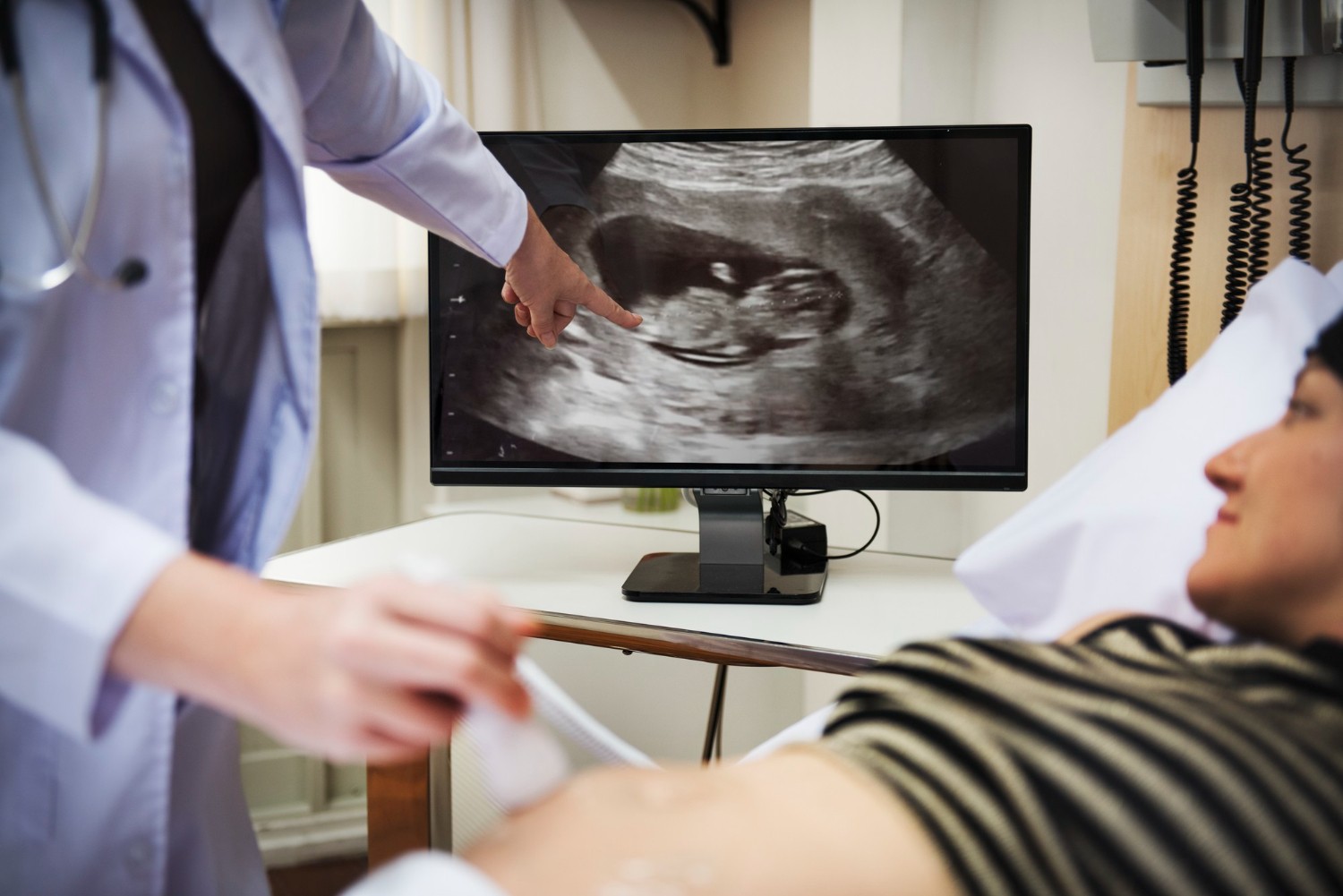 Fetal Echo